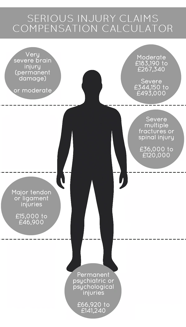 serious injury claim compensation calculator serious injury claim compensation calculator